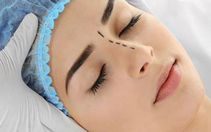 Kosmetisk Plastikkirurgi