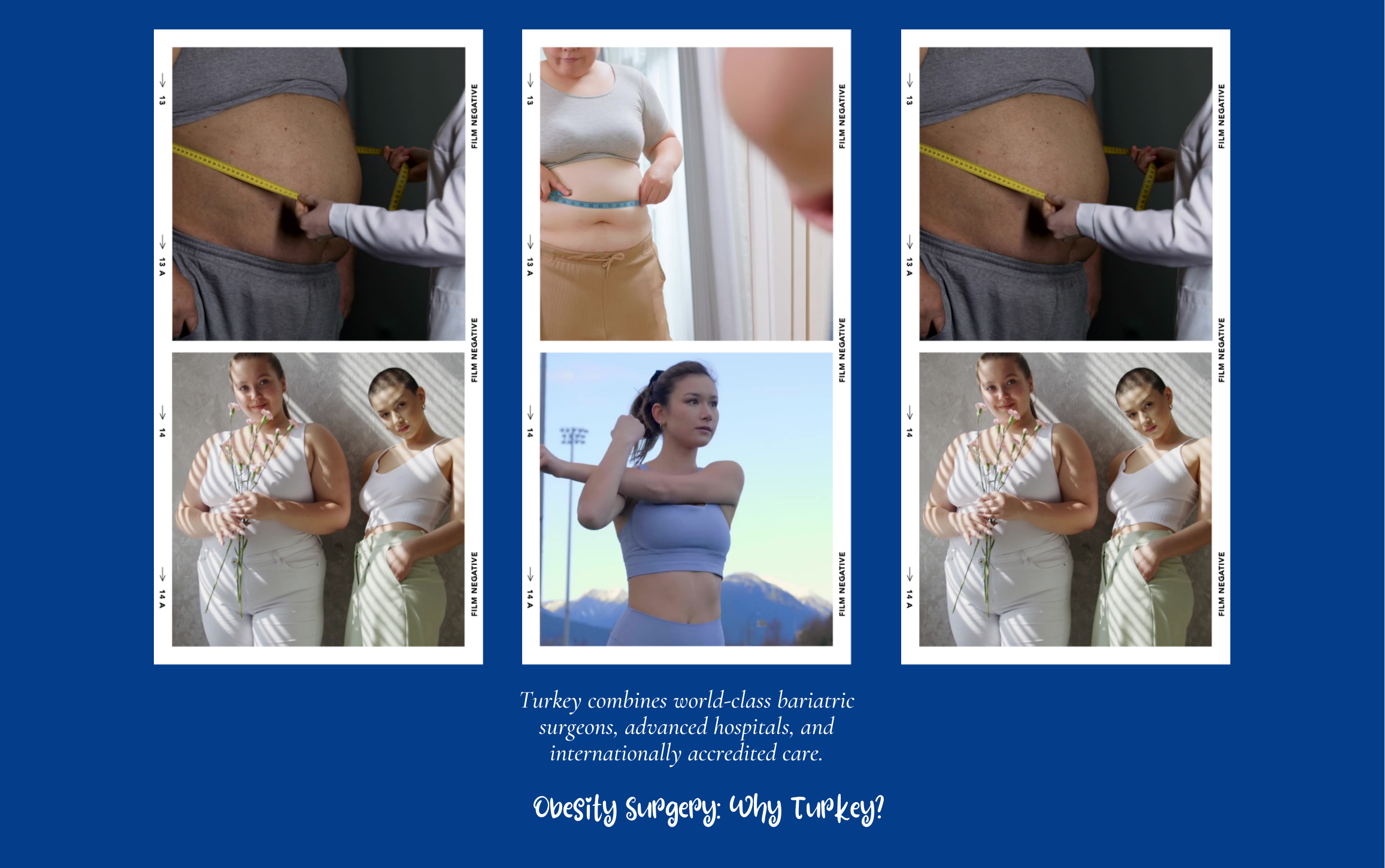 Obesity Surgery: Why in Turkey?